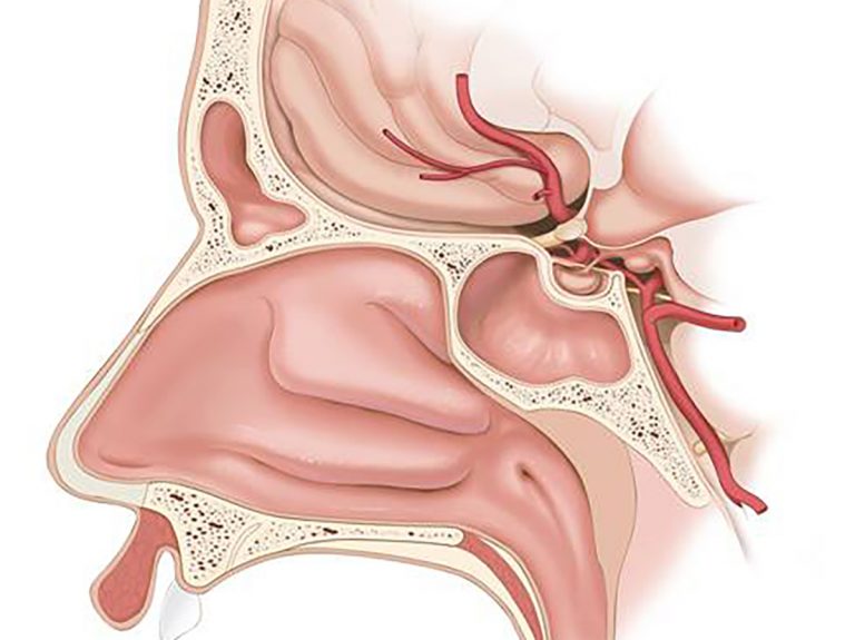 عمل جراحی اندوسکوپی مغز