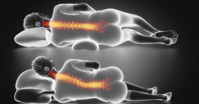 نحوه خوابیدن برای بیماران دیسک گردن
