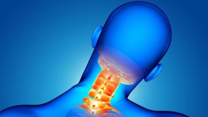 جراحی دیسک گردن