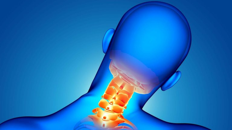 جراحی دیسک گردن