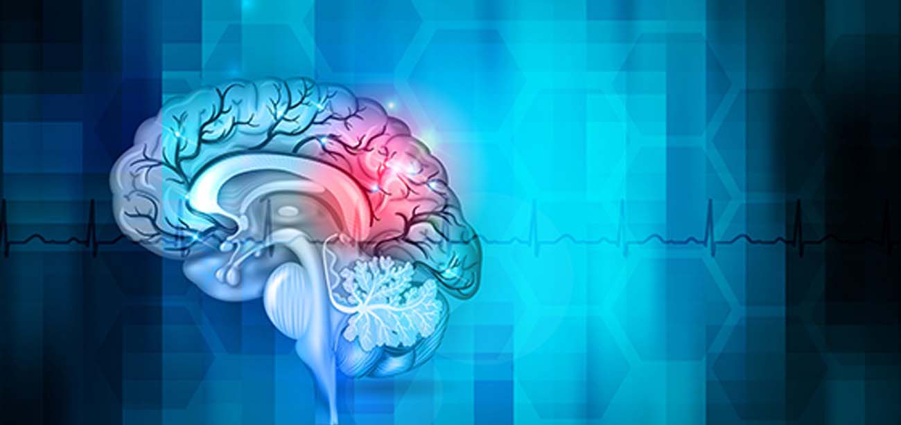 جراحی عروق مغز