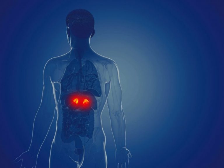 سندروم کوشینگ