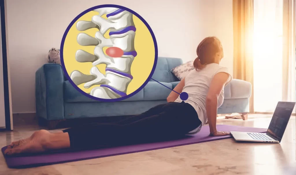 مراقبتهای بعد از جراحی دیسک کمر