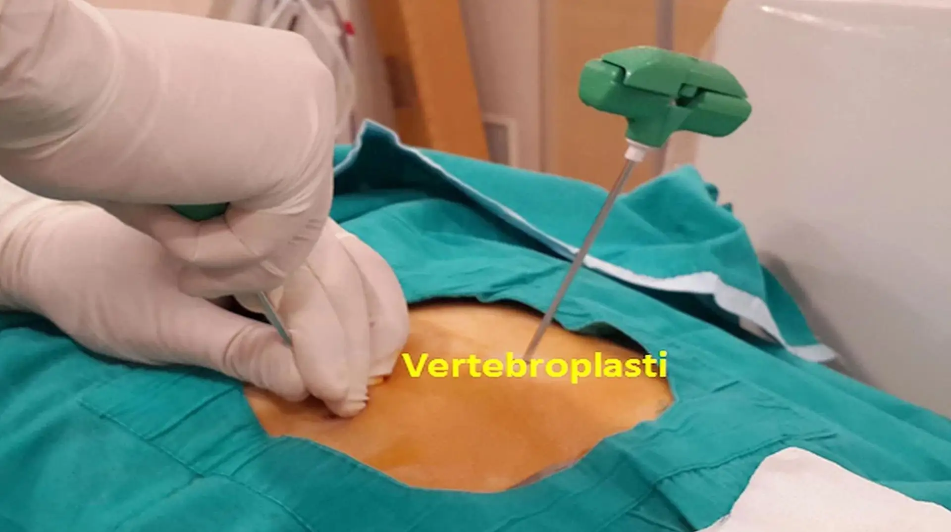 مزایای جراحی ورتبروپلاستی