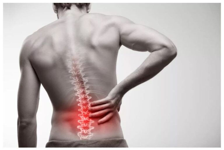 علائم دیسک کمر پیشرفته