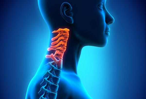 فرق بین آرتروز گردن با دیسک گردن