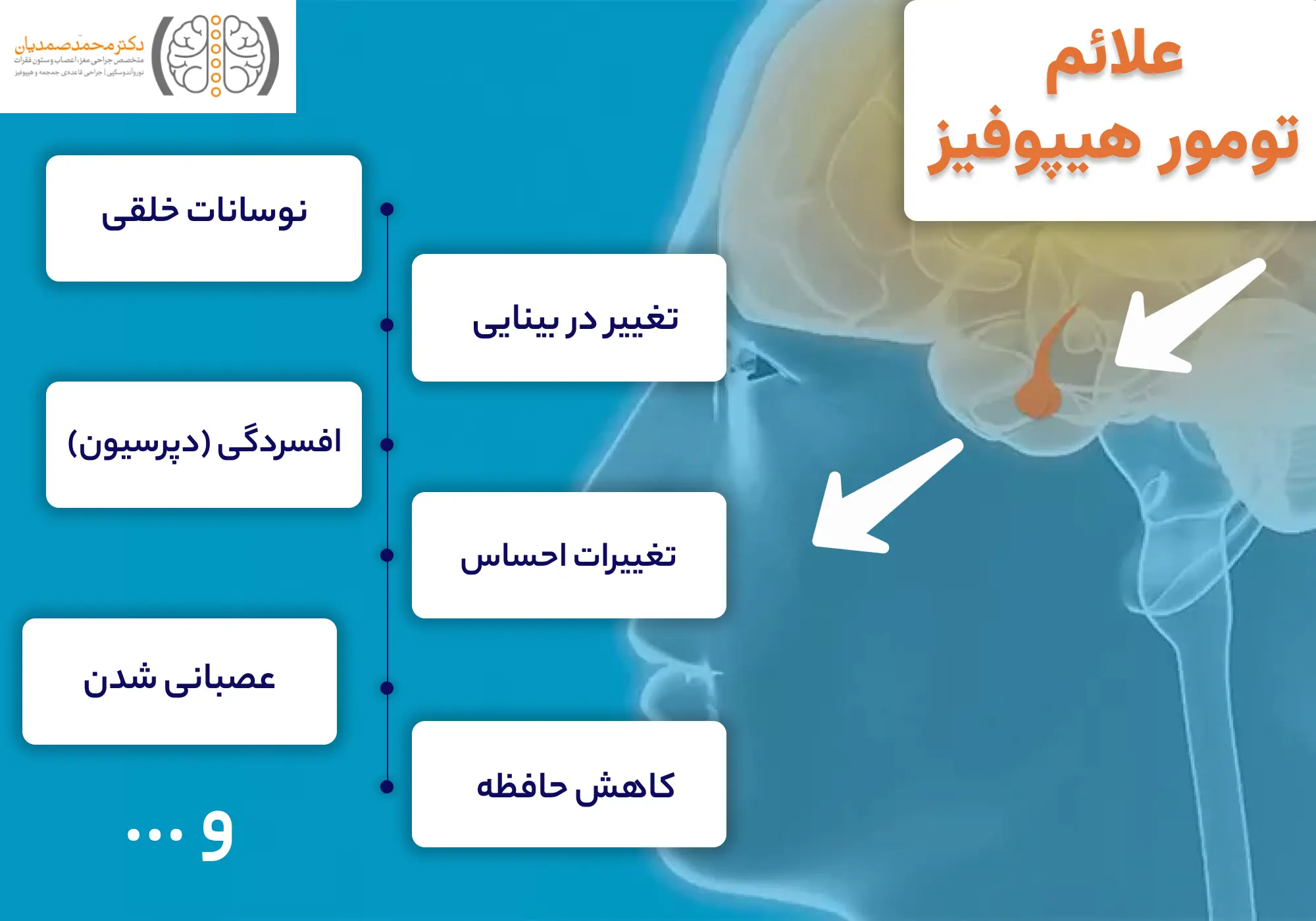 علائم تومور هیپوفیز چیست