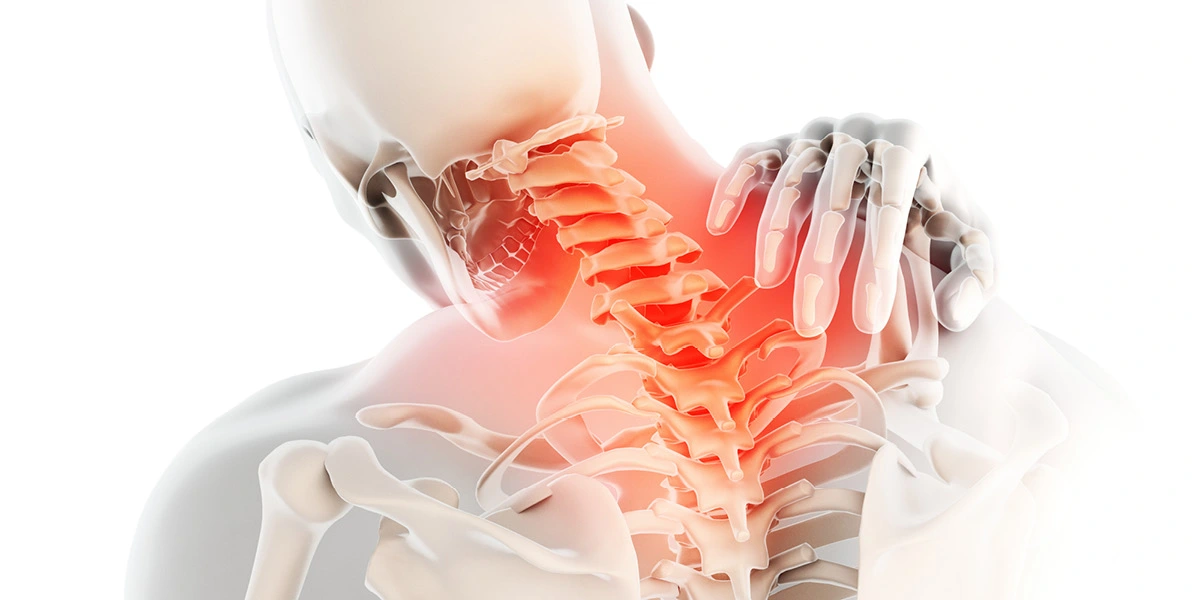 آرتروز گردن چیست